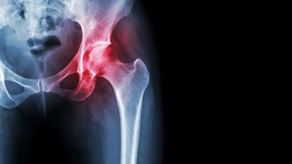 Comparison between the efficacy of fascia-iliaca compartment block and intra-articular hip injection for pre-operative pain management in intracapsular hip fractures