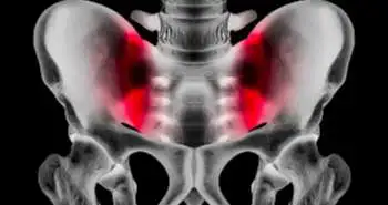 Are bone mineral density and fractures associated with the incidence and progression of radiographic osteoarthritis of the knee, hip and hand in the elderly population?