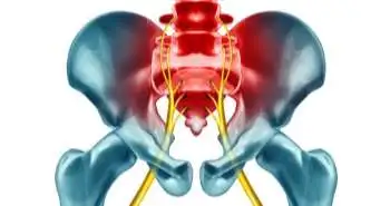 WOMAC and HOOS Index values for asymptomatic and arthritic cohorts