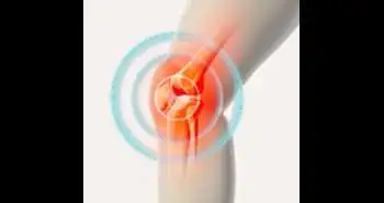 Radiographic parameters for assessing Bone Mineral Density distribution with people with advanced medial osteoarthritis of the knee