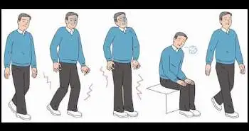 Selective intradural dorsal rhizotomy proved to be effective for persistent radicular leg pain