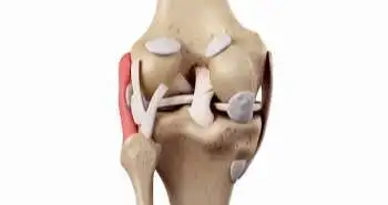 Popliteal neurovascular bundle is safe during inside-out repair of medial meniscus without a safety incision