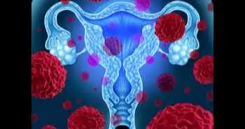 Spectrum of symptoms in women diagnosed with endometriosis during adolescence vs adulthood