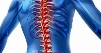 Impaired response to treatment with tumour necrosis factor α inhibitors in smokers with axial spondyloarthritis