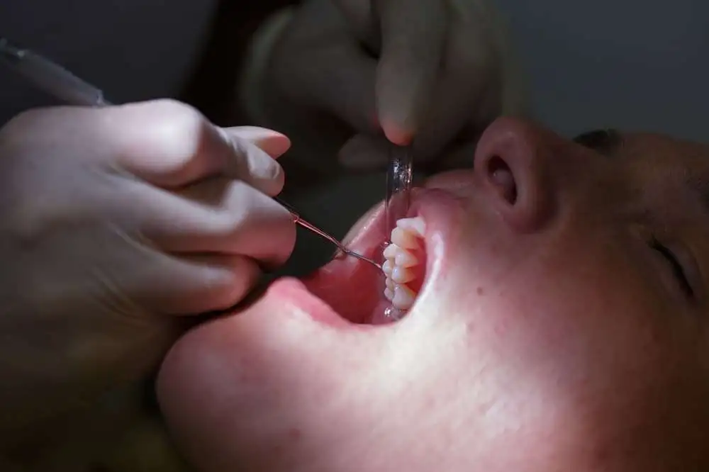 Periodontal regenerative therapy leads to long-term defects reduction and tooth survival