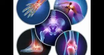 Electrical intramuscular stimulation in osteoarthritis enhances the inhibitory systems in pain processing at cortical and cortical spinal system