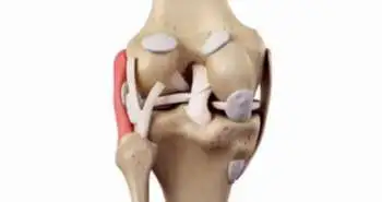 Antioxidative therapy in an ex vivo human cartilage trauma-model: attenuation of trauma-induced cell loss and ECM-destructive enzymes by N-acetyl cysteine