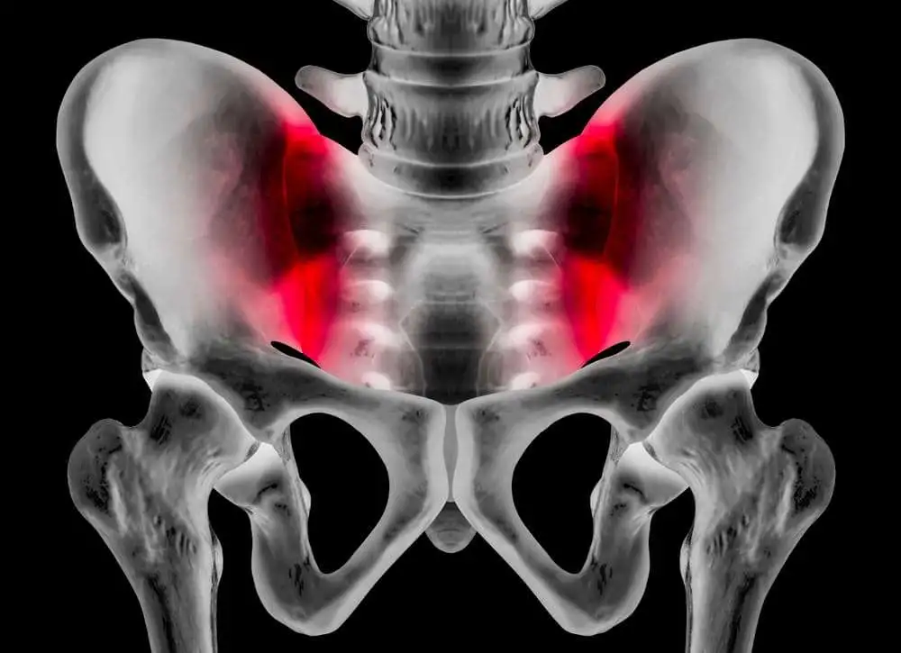 MRI's structural lesions established as a reliable tool to classify patients as per the ASAS axSpA criteria