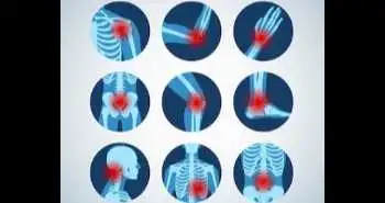 Switching from adalimumab originator to SB5 is feasible for inflammatory rheumatic joint diseases