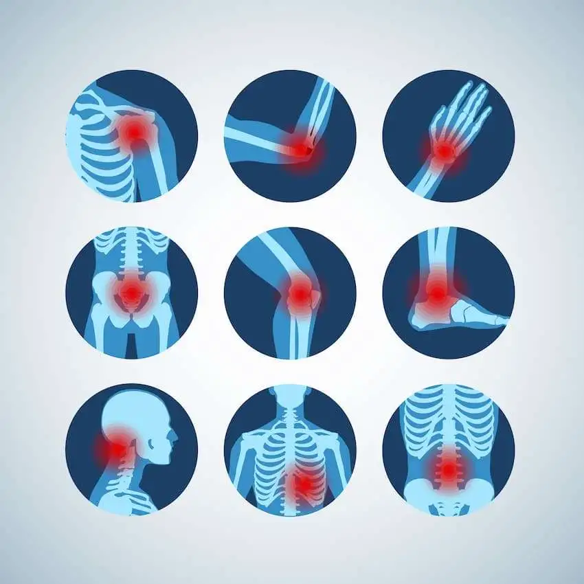 Suitable second-line treatment for Rheumatoid Arthritis, Psoriatic Arthritis, and Ankylosing Spondylitis