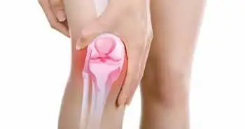 Negative-pressure wound therapy found effective after total knee arthroplasty