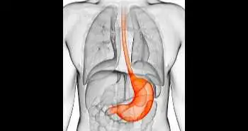 EndoFLIP and Pyloric Dilation improved symptoms in gastroparesis patients refractory to Pyloromyotomy/Pyloroplasty