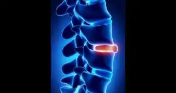 Effectiveness of vertebral cancellous bone infiltration anaesthesia during percutaneous vertebroplasty