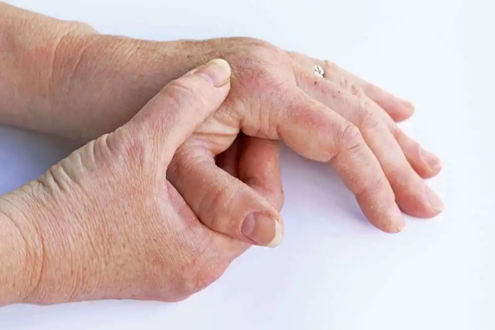 Bisphosphonate use to improve bone mineral density in RA patients