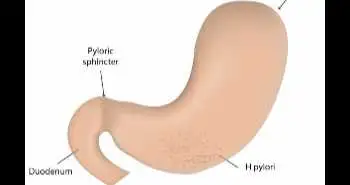 Study evaluates efficacy of novel sequential treatment regimen containing bismuth to treat H. pylori