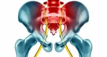 Pericapsular nerve group block improves short-term analgesia in hip fracture surgery