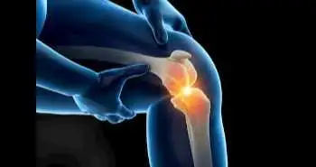 knee_arthroplasty