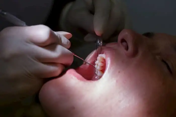 Dental.pain