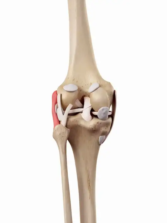 Total Knee Arthroplasty