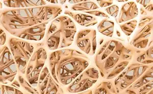 Management of Osteoporosis