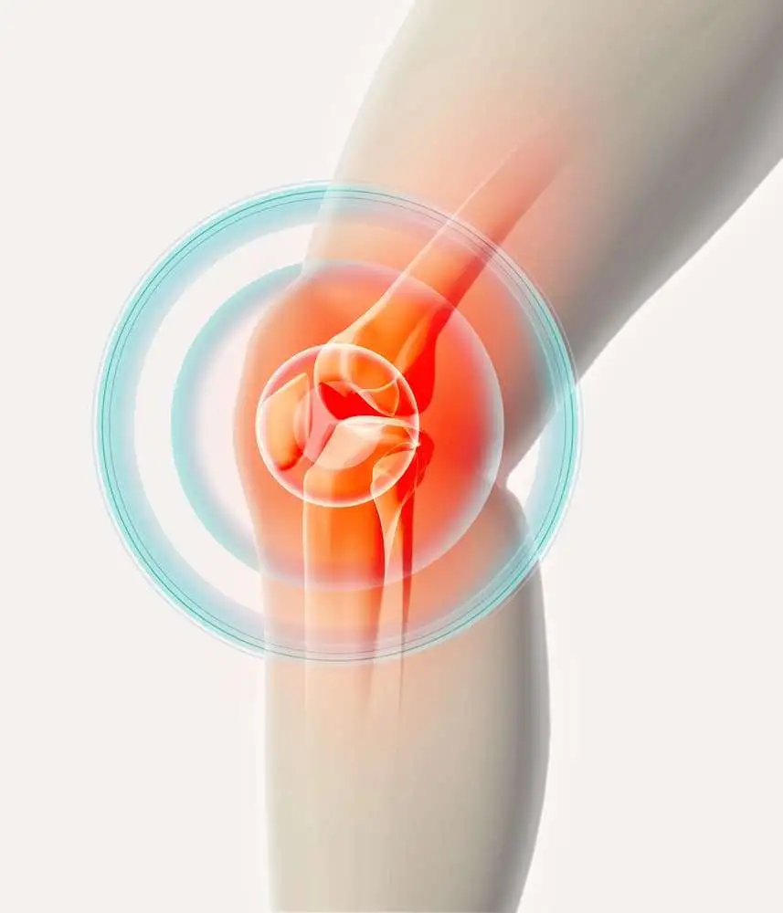 Synovitis and the risk of knee osteoarthritis: the MOST Study