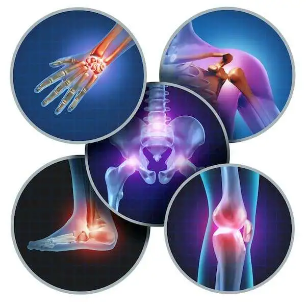 Importance of Urinary proteomics for distinct diagnostic inflammatory arthritis subgroups