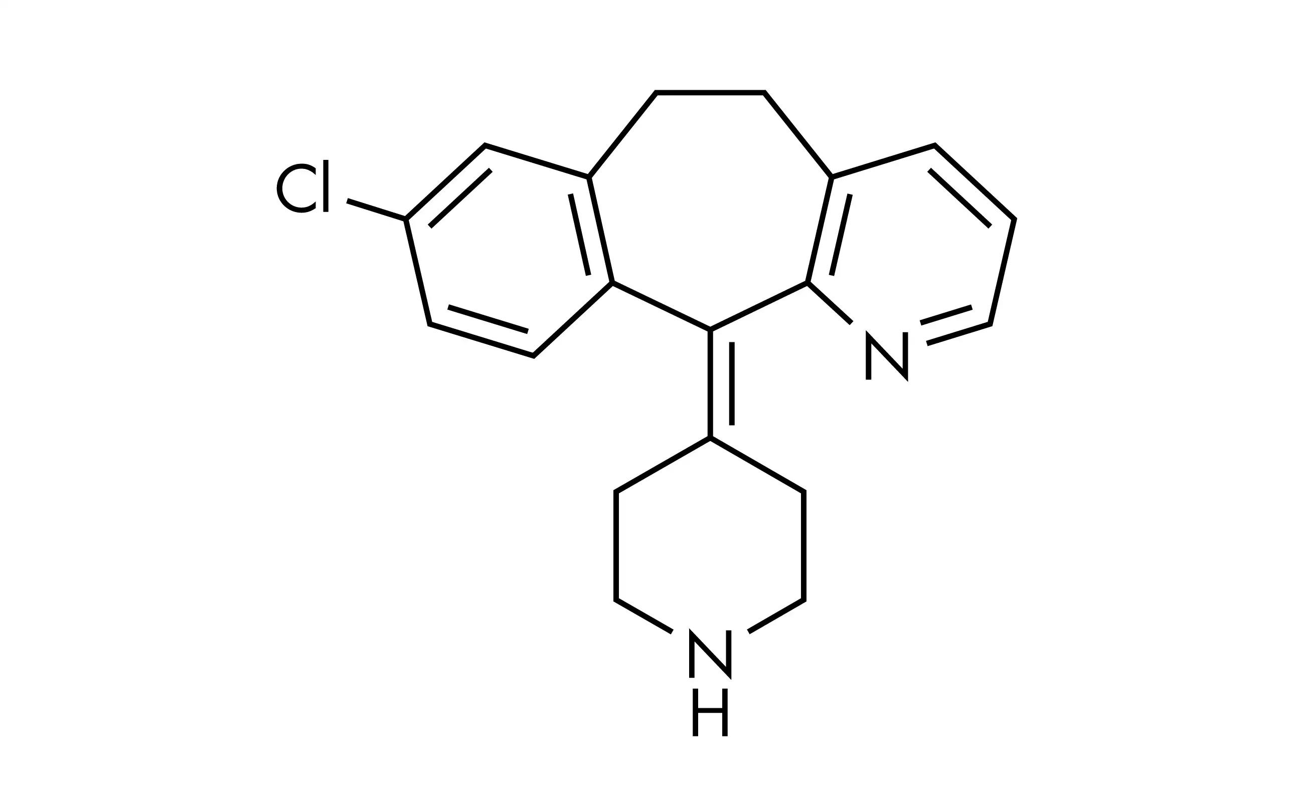 Allergic rhinitis