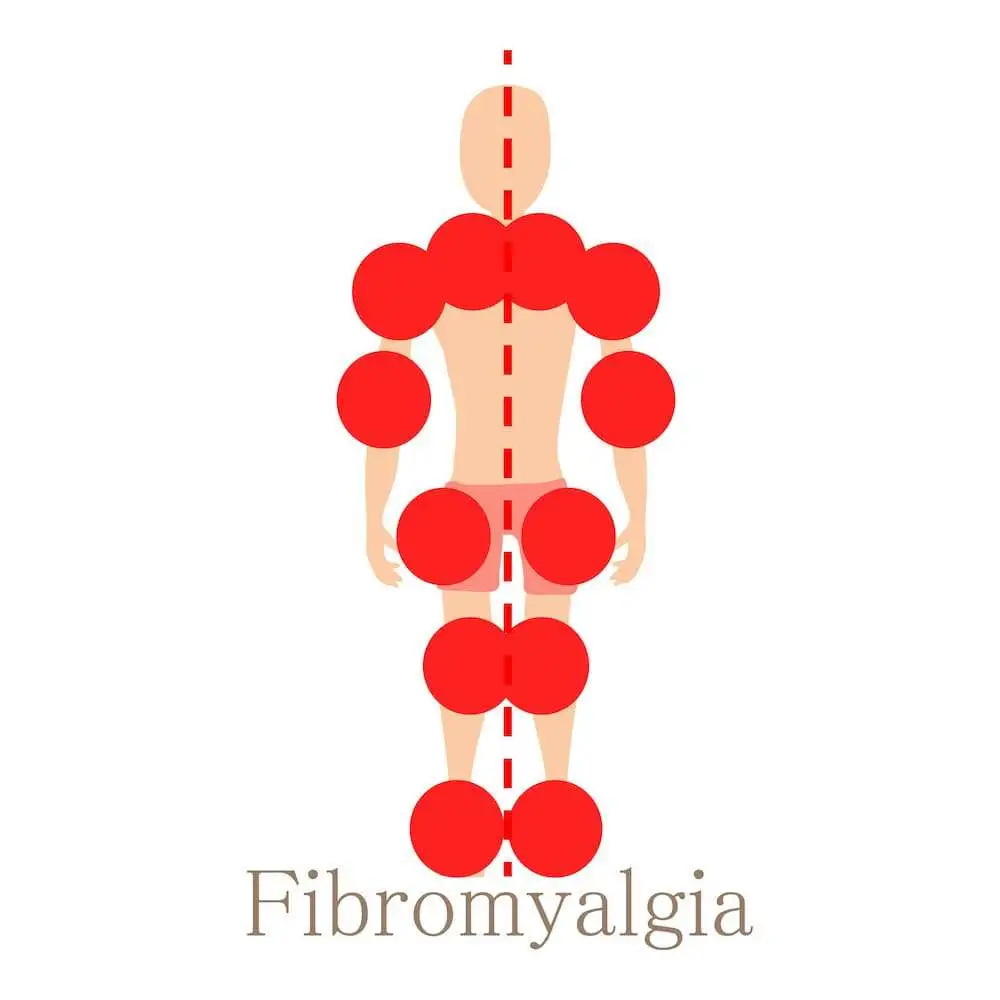 Effect of intravenous lidocaine combined with amitriptyline on pain intensity, clinical manifestations and the concentrations of IL-1, IL-6 and IL-8 in patients with fibromyalgia: A randomized double-blind study