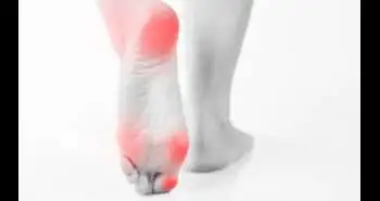 Muscle trigger points and pressure pain sensitivity maps of the feet in women with fibromyalgia syndrome