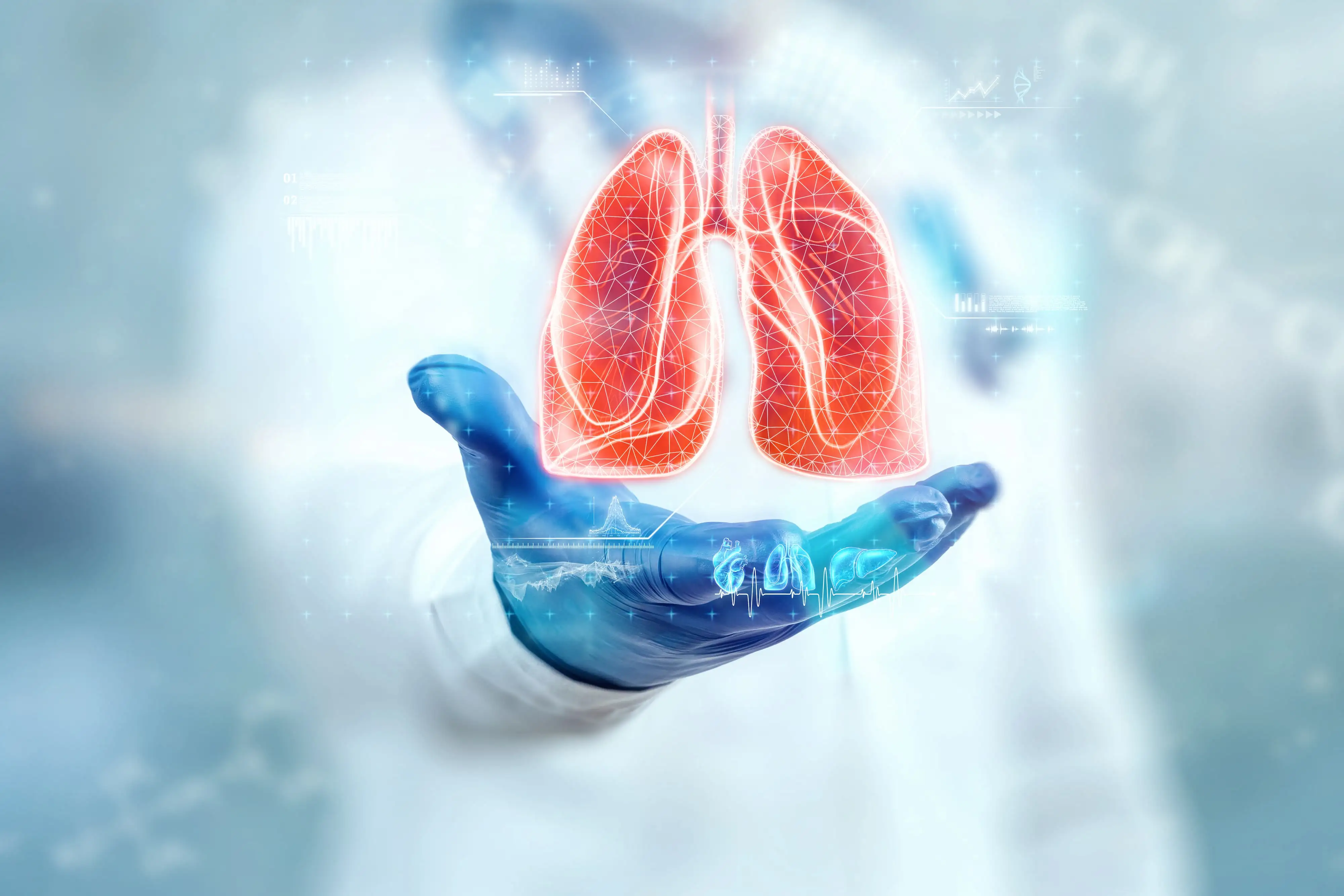 Eosinophilic Asthma