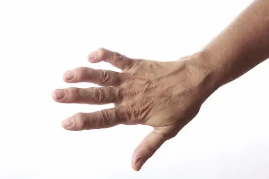 Rheumatoid arthritis